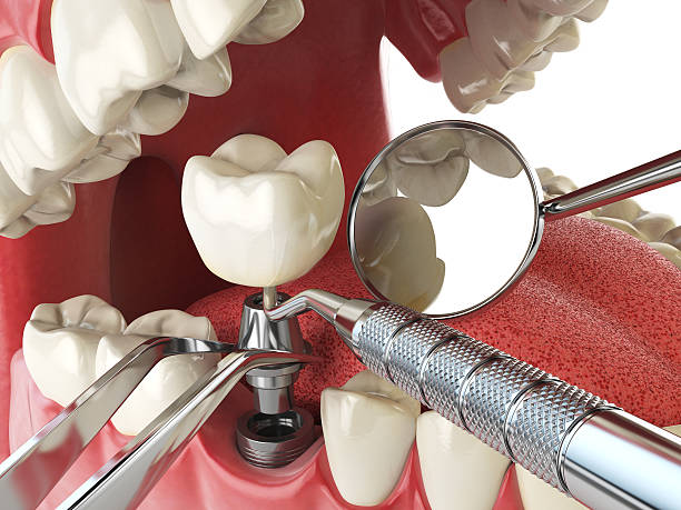 Best Emergency Dental Care for Broken or Chipped Teeth in Bonham, TX